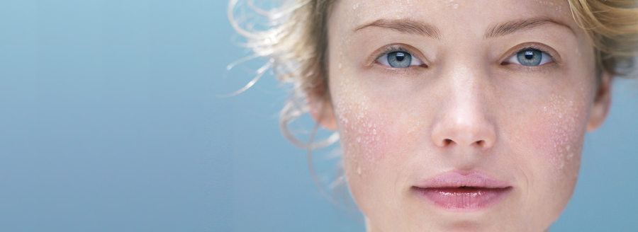 ¿Cómo cuidar de la pieles alérgicas?