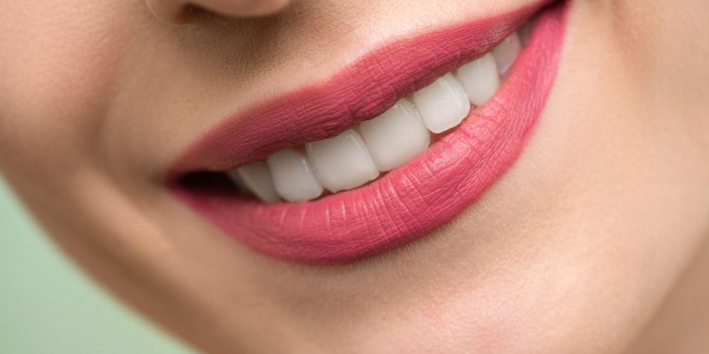 ¿De qué se trata el blanqueamiento de dientes con carbón?